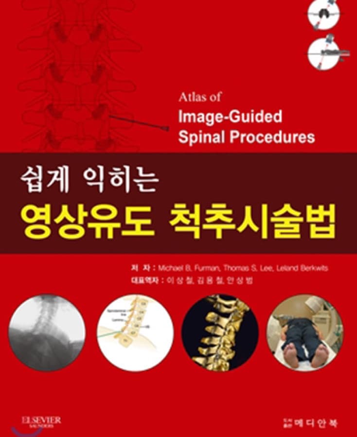 쉽게 익히는 영상유도 척추시술법 표지