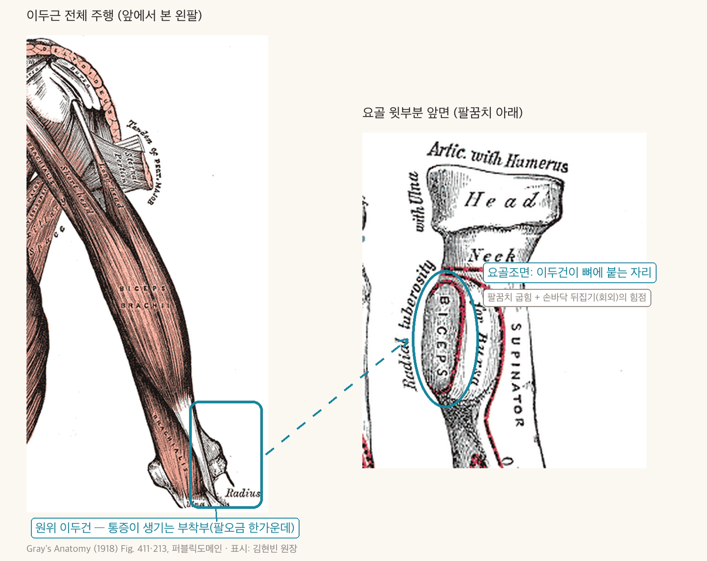 이두근 전체 주행과 요골조면 부착부 해부 그림 - 원위 이두건이 팔꿈치 앞 팔오금을 지나 요골 윗부분 안쪽의 요골조면에 붙는 자리를 청록색으로 표시