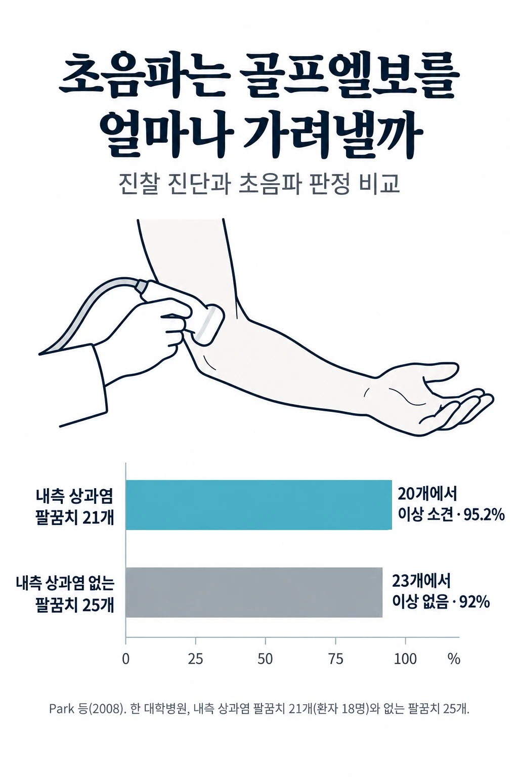 초음파가 골프엘보(내측 상과염)를 얼마나 가려냈는지 보여 주는 막대그래프. 내측 상과염으로 진단된 팔꿈치 21개 중 20개에서 이상 소견(민감도 95.2%), 내측 상과염이 없는 팔꿈치 25개 중 23개에서 이상 없음(특이도 92%).