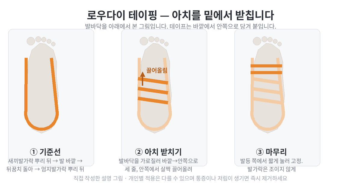 발바닥을 아래에서 본 세 컷 도해. 기준선을 발 바깥에서 뒤꿈치를 돌아 안쪽까지 붙이고, 발바닥을 가로질러 세 줄을 바깥에서 안쪽으로 끌어올려 붙인 뒤, 발등 쪽에서 짧게 눌러 고정하는 순서