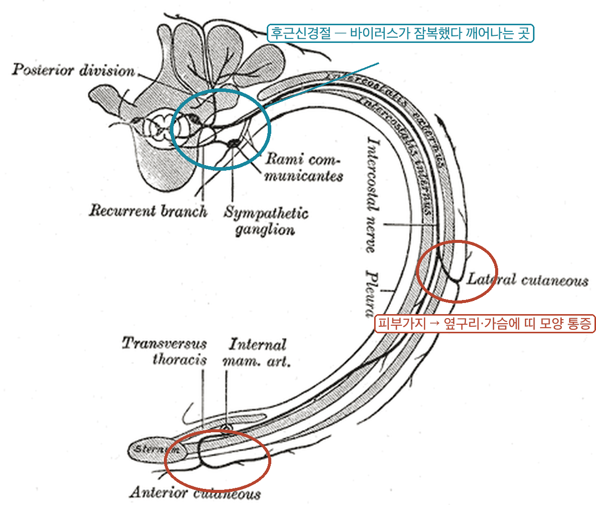 늑간신경 경로 해부 도판 - 바이러스가 잠복하는 후근신경절(청록 원)과 옆구리·가슴 피부로 나오는 피부가지(테라코타 원) 표시, 대상포진후신경통의 해부