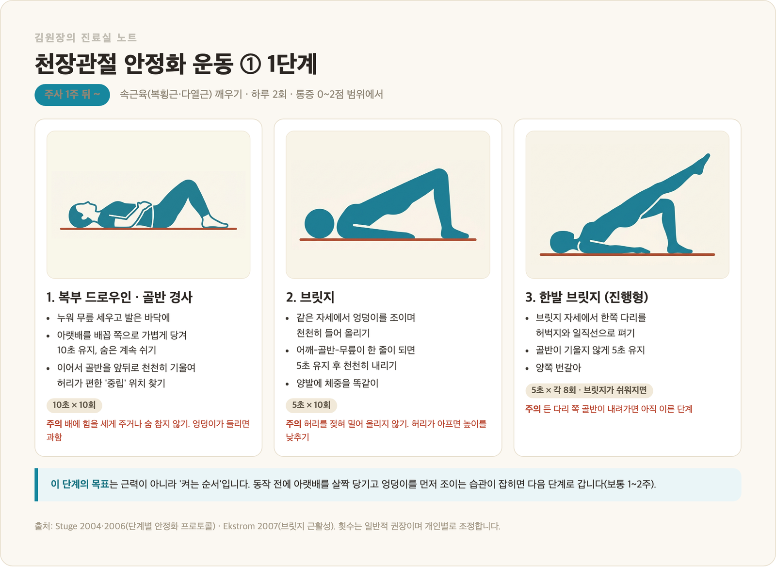 천장관절 안정화 운동 1단계 카드 - 복부 드로우인과 골반 경사 10초 10회, 브릿지 5초 10회, 한발 브릿지 5초 각 8회, 동작 그림과 흔한 실수