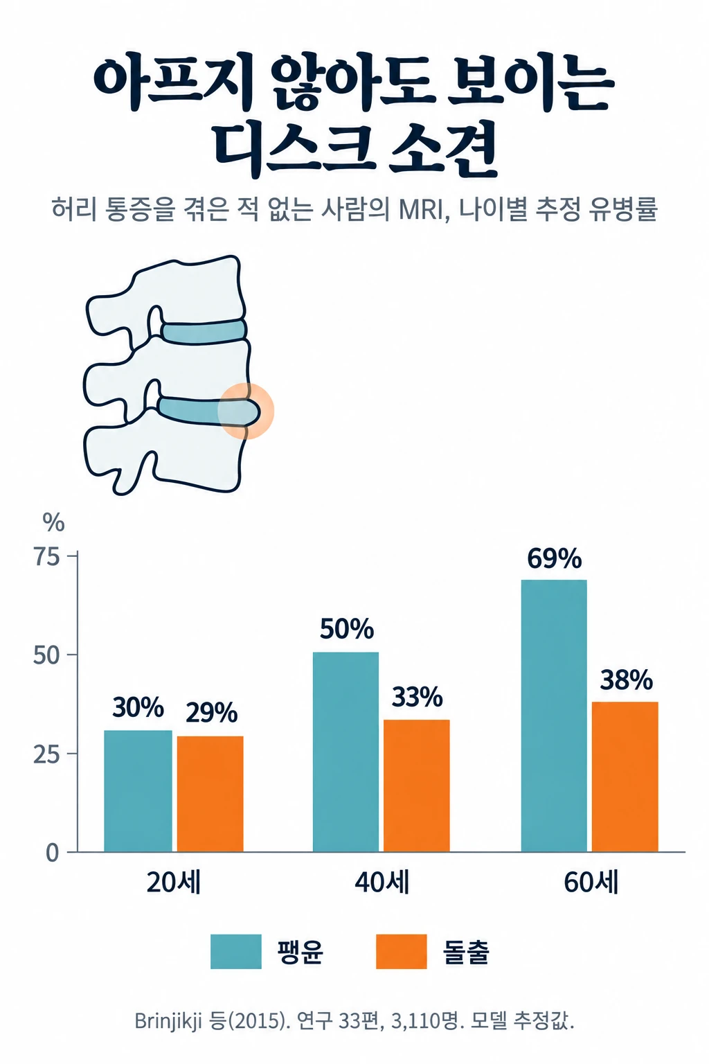 옆으로 본 허리 척추 선 그림과 허리 통증을 겪은 적 없는 사람의 MRI 소견 나이별 추정 유병률 막대그래프. 디스크 팽윤은 20세 30%, 40세 50%, 60세 69%, 디스크 돌출은 20세 29%, 40세 33%, 60세 38%였습니다.