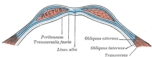 배 앞벽을 가로로 자른 모식도. 가운데 백선(Linea alba)을 사이에 두고 양쪽에 복직근(Rectus)이 있고, 옆으로 외복사근(Obliquus externus), 내복사근(Obliquus internus), 복횡근(Transversus) 세 층이 이어진다. 근육층 안쪽으로 가로근막(Transversalis fascia)과 복막(Peritoneum)이 선으로 표시돼 있다